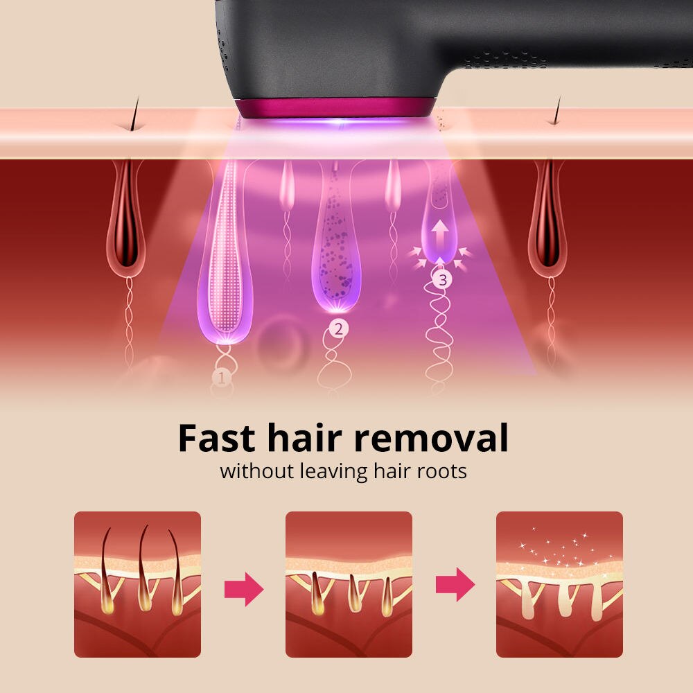 IPL Hair Removal Device: 10 0000 Flashes